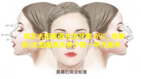 鸡东太田痣激光治疗费 🕸 用解析(太田痣激光多少钱一平方厘米)